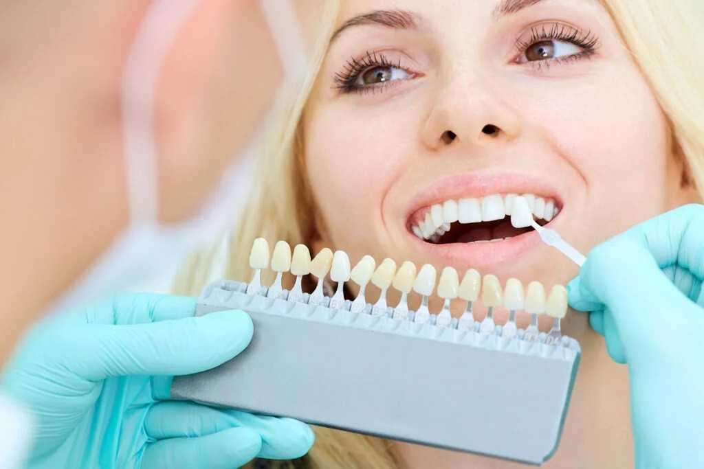 teeth whitening services