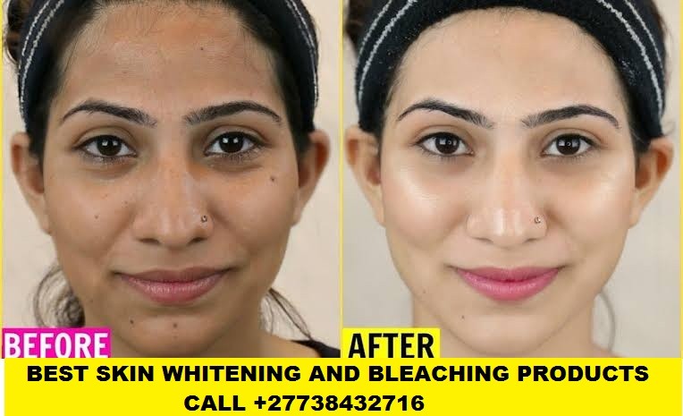 Permanent Skin Lightening Skin Whitening Products +27738432716