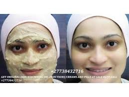 Permanent Skin Lightening Skin Whitening Products +27738432716-pic_1